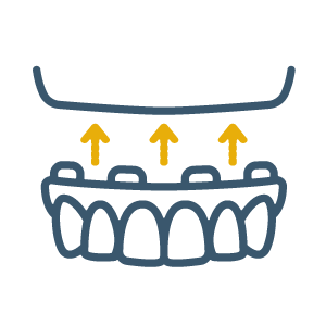 Full and Partial Dentures