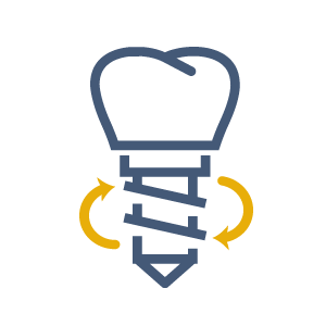 Dental Implants Overview